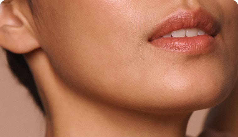Result - Kybella®