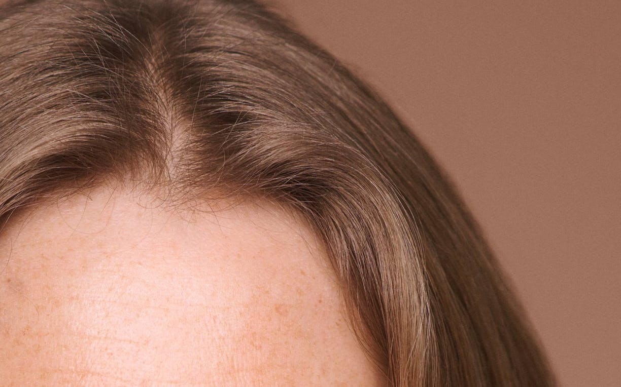 Plasma Hair Restoration
